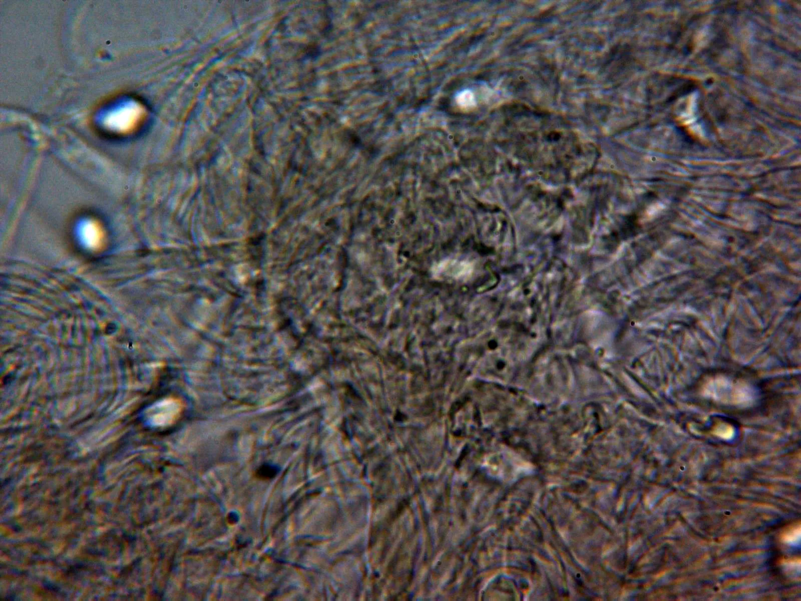 Microscopía de Mycena alcalina - 10 - Suprapellis agua 1